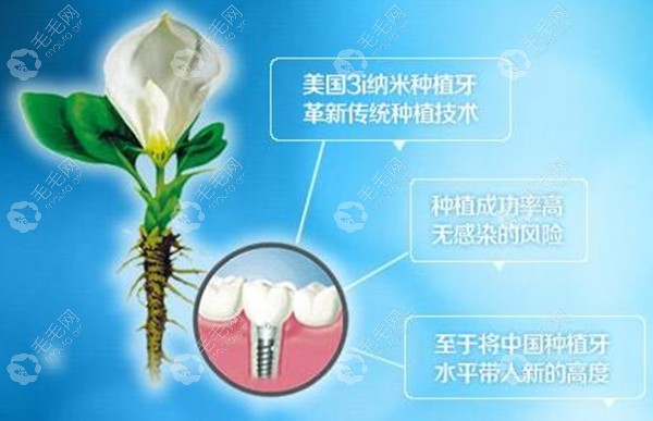 美国3I种植体系统有几个型号,听说植体的材料和质量都一样