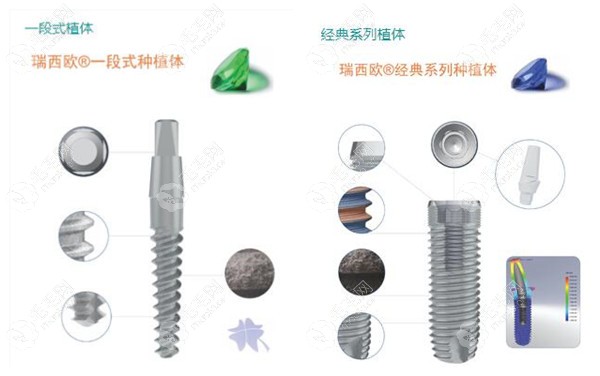 德国瑞西欧种植牙的价格是多少钱