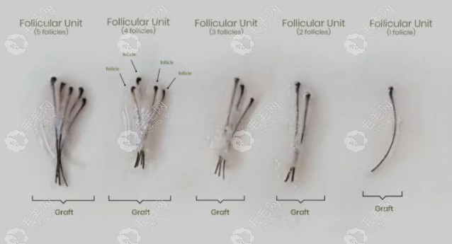 毛发1-4根为一个单位