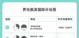 五级脱发种植多少单位能盖住头皮,3000单位够不够?
