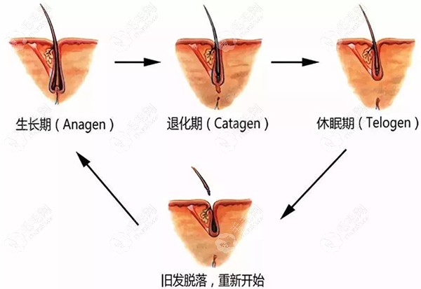 通过毛囊激活再生疗法来刺激毛囊再生发际线,真的靠谱吗