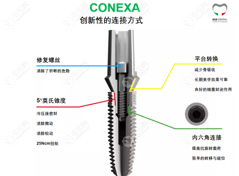 bb种植体的链接方式也不同