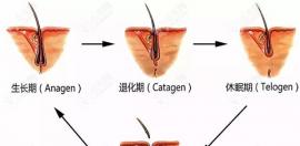 通過毛囊激活再生療法來刺激毛囊再生發(fā)際線,真的靠譜嗎