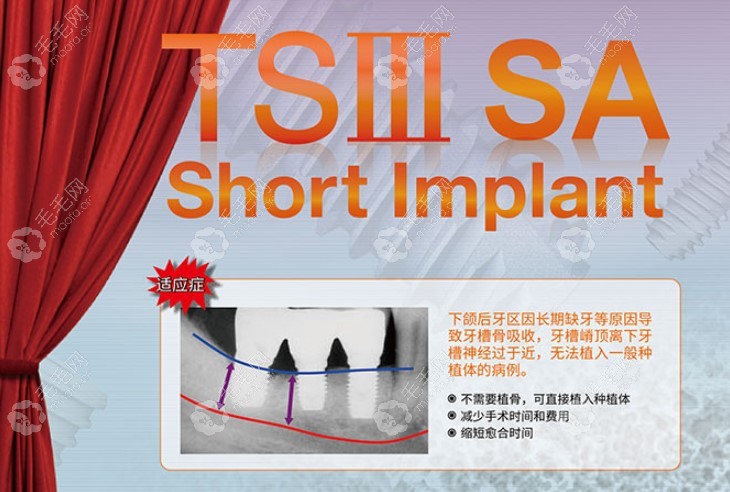 奥齿泰ts3sa短种植体适应症状