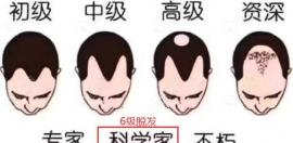 马蹄形脱发不一定可以用植发手段治疗,具体看毛囊检测结果