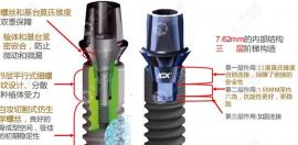 同为四级钛植体的德国icx与韩国奥齿泰、登腾对比哪个好用