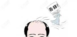 怎么判断是肾虚型脱发?脂溢性(雄脱)和肾虚脱发的区别必看