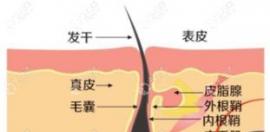 请问植发中的一个毛囊单位是一根头发的意思吗