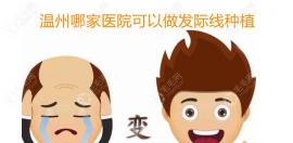 公布温州发际线种植哪个医院好以及种m发际线的价格是多少