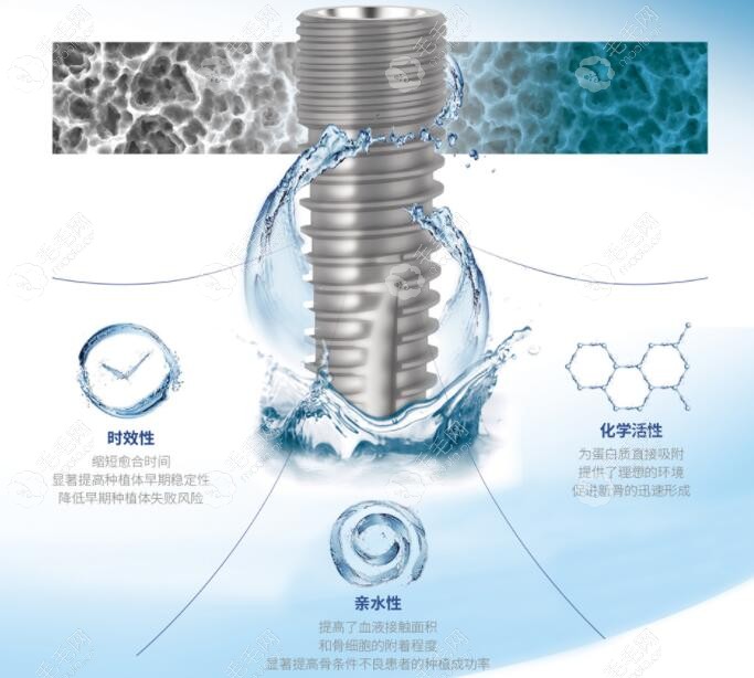 泰山康盛亲水型种植体