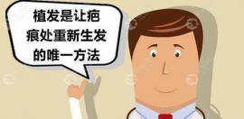 疤痕植發(fā)成功率是多少?是不是毛囊存活了就表示手術(shù)成功了