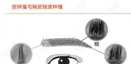 眉毛种植用fut还是fue好不光看植眉的价格还要看技术区别