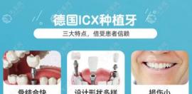 德國(guó)icx的Active活性親水及迷你等種植體型號(hào)和價(jià)格都在這嘍