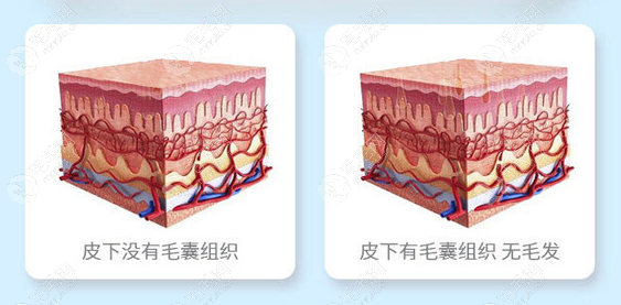 苏州植发专科医院：下面有3家都是做无痕技术的口碑医院哦