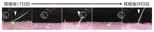 日本毛囊再生技术是不是植发,2021年毛囊干细胞克隆有新进展