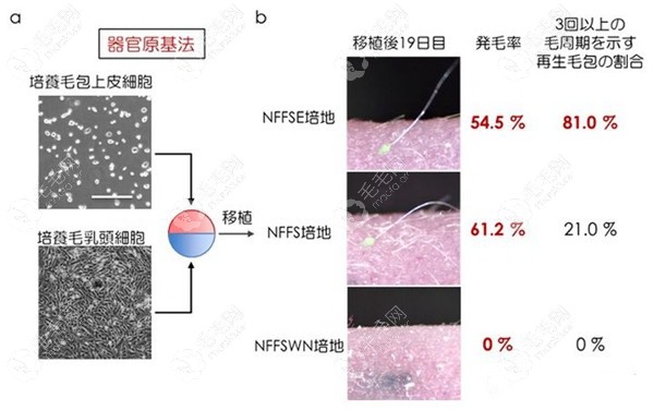 毛囊克隆再生技术的原理