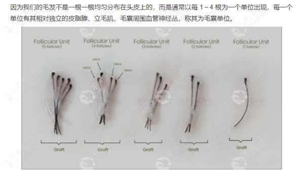 毛囊及头发根数的概念