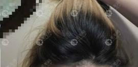 头发从发根长还是从发梢长的?头发为什么会分叉给我搞懵了