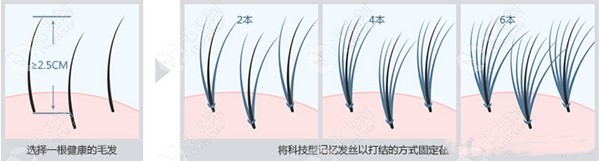 物理增发1000根要多少钱?美丝珈和黑黛不同物理增发价格不等