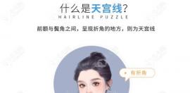 讲天宫线植发是哪个部位什么意思啦,额宽太阳穴凹陷者入