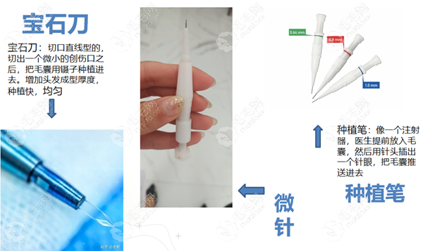 联合种植植发技术各工具