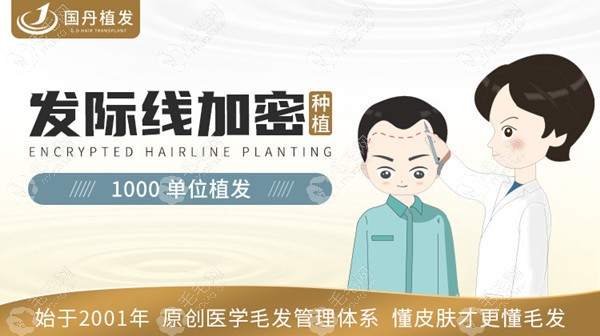 发际线植发1000单位的示例