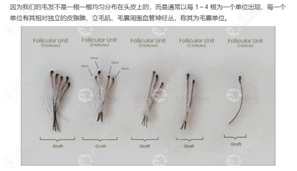 毛囊与头发根数的概念