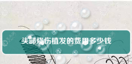 上海头部烧伤植发多少钱这个参考价可作选择医院时的标准