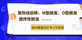 滁州市没有植发的医院,那么哪里治疗青少年脱发呢