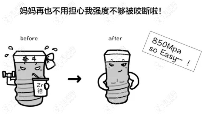 种植牙材料不一样强度不一样