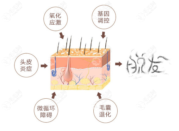 检查的目的要知道具体是什么原因导致脱发才好改善