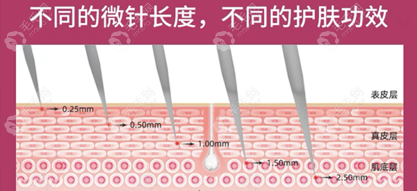 微针生发用几毫米针头才有效