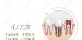 据说种植牙的成功率高达99.339%,判断种植牙的成功标准是什么