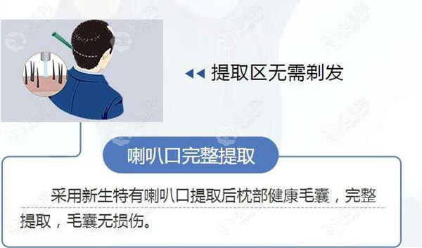 新生nocut不剃发植发采用喇叭口提取，毛囊完整度高