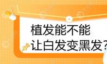 白发可以植发变成黑发吗,我前额少量白发能经过植发改善吗