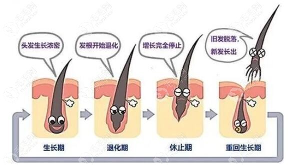 丝科慕中胚和米诺地尔搽剂一起用加快头发生长