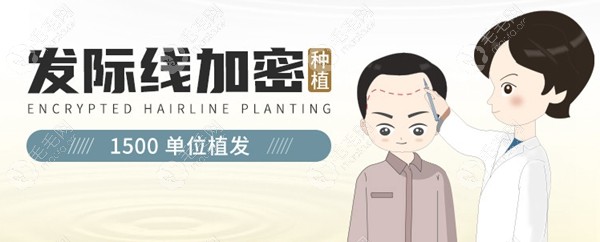 咸阳发际线种植1500单位费用