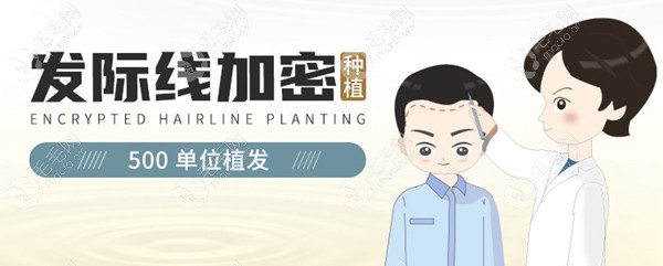 光知咸阳植发际线大概多少钱怎行,秃顶微针植发价格表要有