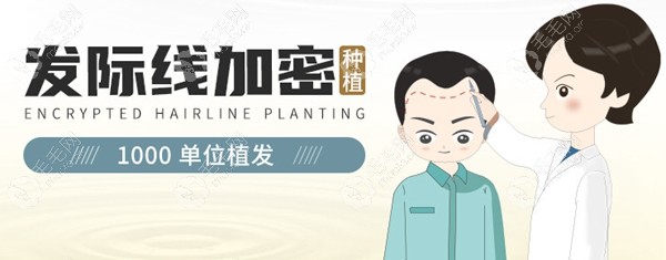 咸阳发际线植发1000单位价格