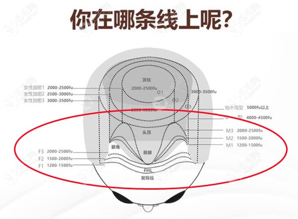 植发2000单位大概有多大面积