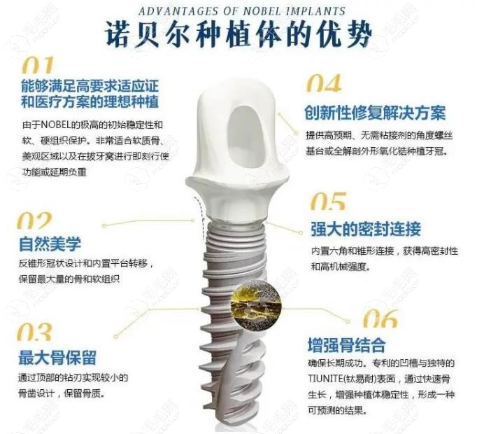 瑞典诺贝尔种植牙pmc与pcc哪个好