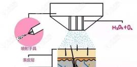植發(fā)醫(yī)院的水氧光療對(duì)頭發(fā)有用嗎?摸清什么原理啥作用自現(xiàn)