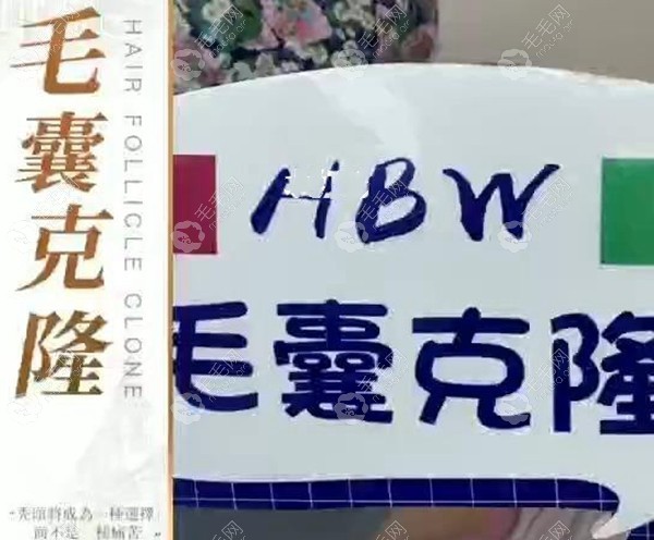 HBW毛囊克隆植发技术