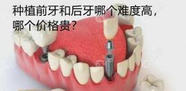 解答:分别种植门牙和大牙的难度和价格是否一样