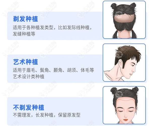 南宁碧莲盛还有剃发种植、艺术种植、不剃发种植