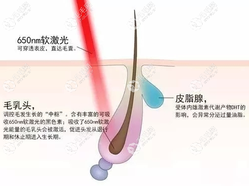 650nm波长对激活毛囊有效