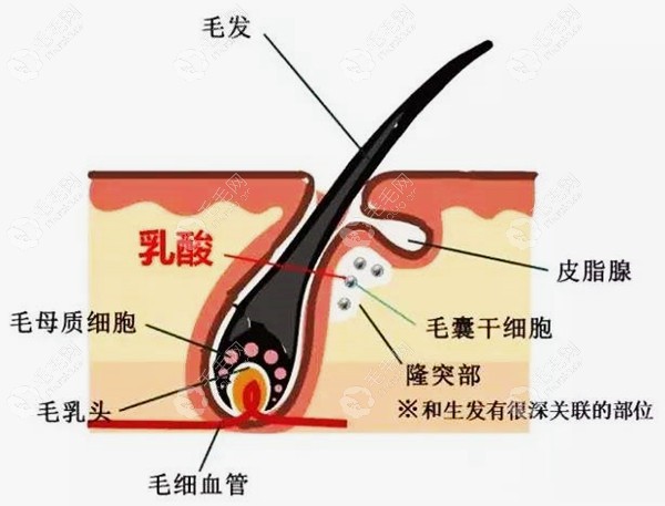 肥胖导致毛囊减少引起脱发.jpg