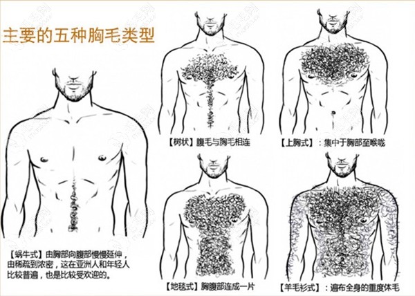 体毛种植视频/图片来一波,种过体毛发友分享成活率是多少