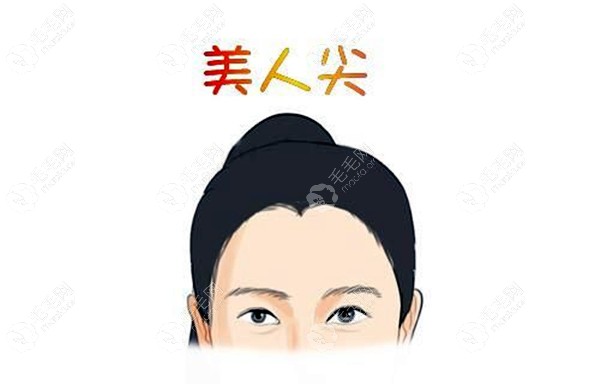 美人尖.jpg