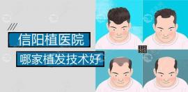 信阳哪家植发医院技术比较好?易韩/金霞/东方艺植发怎么样